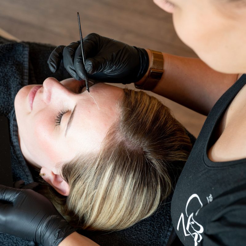fillers maastricht